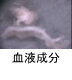 異物同定例:血液成分